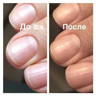 Витамины для красивых ногтей: что есть, чтобы их укрепить и придать блеск.