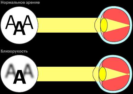 Здоровье глаз: как ухаживать за зрением